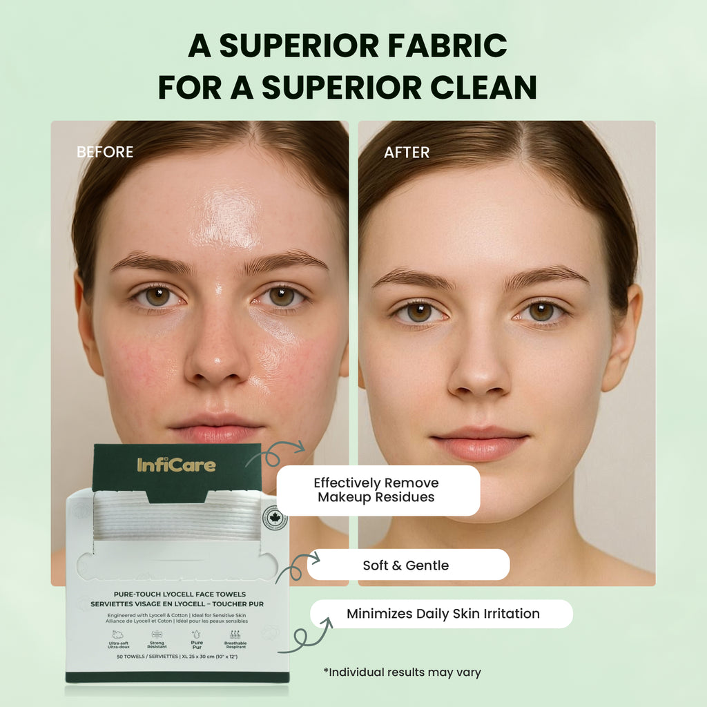 Before and after comparison of a person's face with infiCare facial towels displayed.